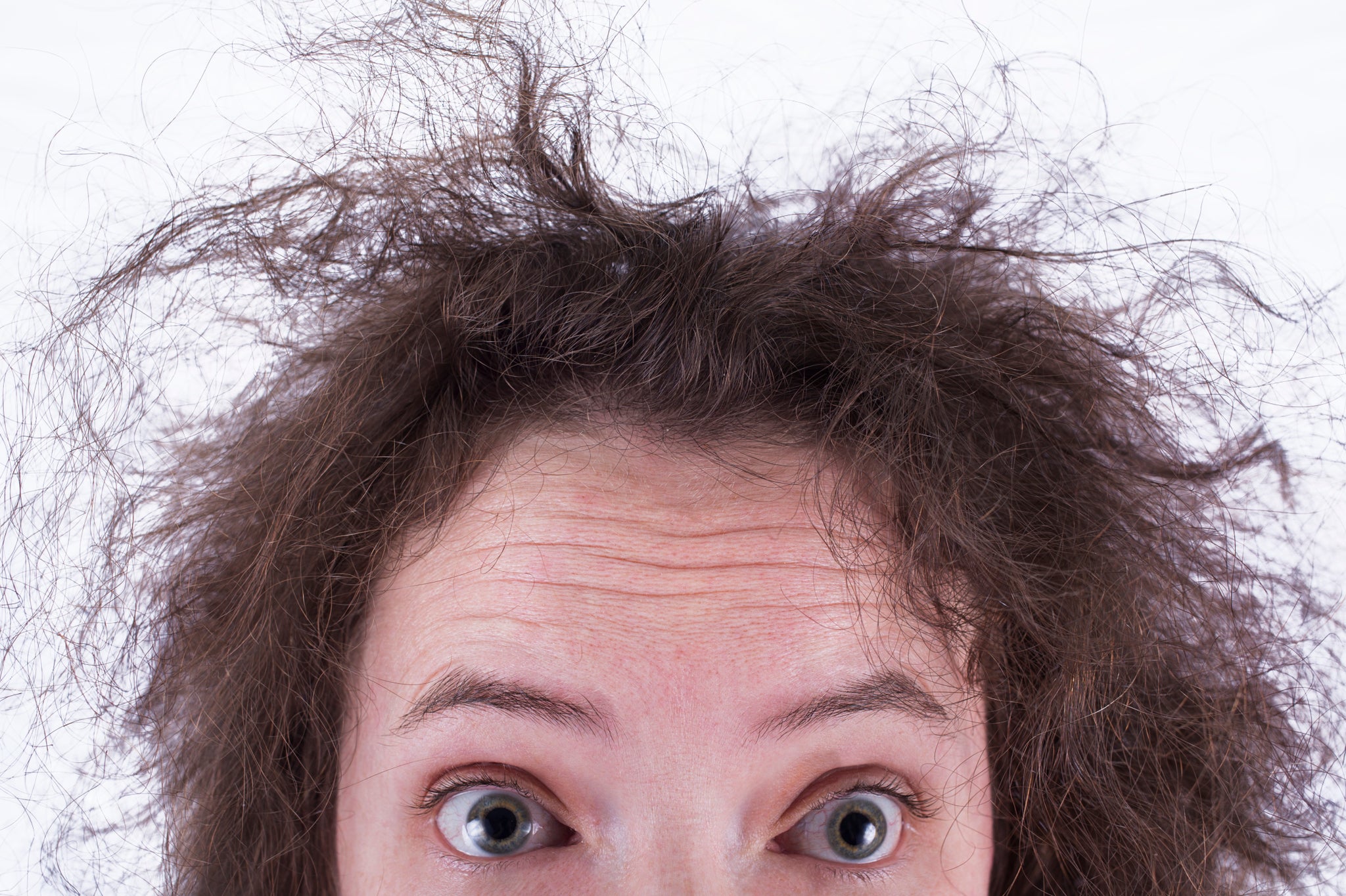 Dry And Frizzy Hair: 14 Natural Ways To Treat The Condition – Vedix